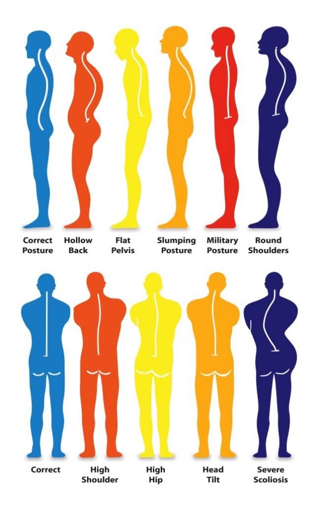 illustration of different postures and spine curvature